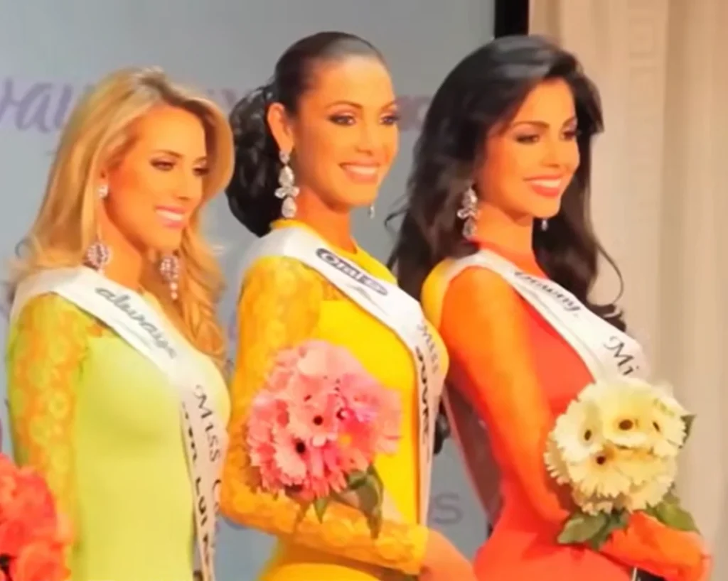 Cosmetic Surgery is one of the amazing facts about Venezuela