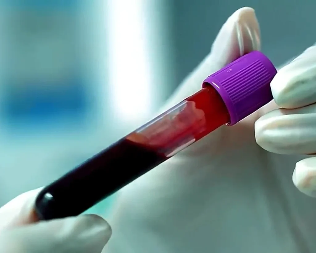 Classification Of Blood Type is one of the interesting facts about Austria